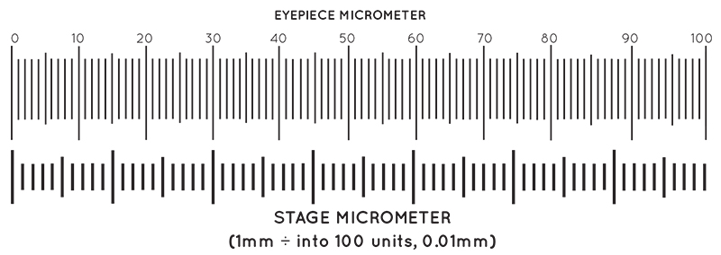 Migraine ocular